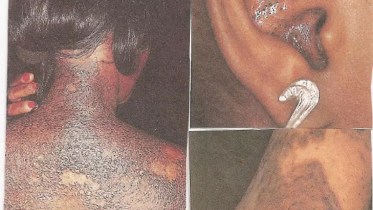 A Dangerous Desire To Have Fairer Skin